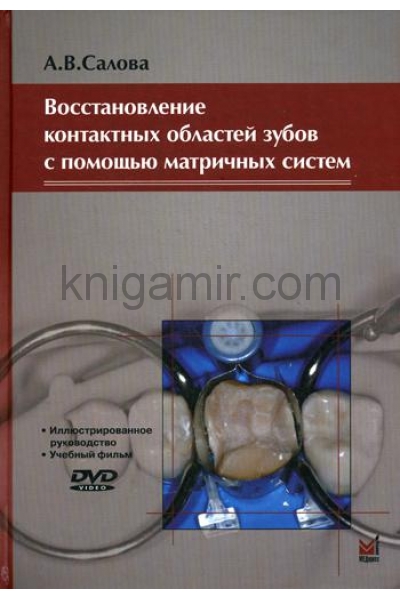 обложка Восстановление контактных областей зубов с помощью матричных систем. 2-е изд., + CD от интернет-магазина Книгамир
