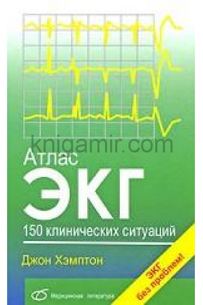 обложка Атлас ЭКГ. 150 клинических ситуаций от интернет-магазина Книгамир